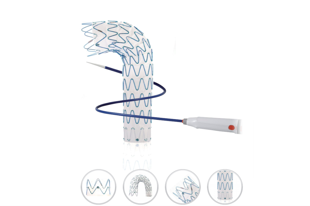 ODM Thoracic Aortic Stent Graft System for Minimally Invasive Aortic Aneurysm Repair